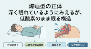 睡眠の質の正体新シリーズ:第2回──深く眠れているように見える|爆睡型は