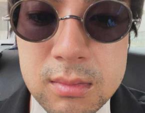 山田裕貴、親知らず抜歯でまさかのフェイスラインに　“ふにゃふにゃ声”に「かわいい」「お大事に」と反響