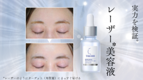 タカミのレーザー美容液がすごい！ シミ予防としわ改善に効果があるって本当？実際に使ってみた正直な感想