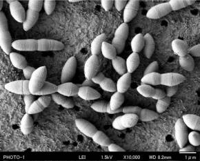 がん免疫療法の効果高める腸内細菌を発見　新薬へ応用も　研究発表