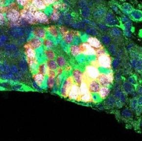 マウスで「精子のもと」作るのに成功　不妊治療に期待　大阪大など