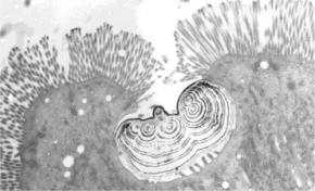 獲物の「骨を消化」する新細胞をニシキヘビで発見