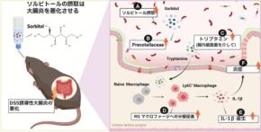 人工甘味料が腸炎を悪化させる仕組みを解明