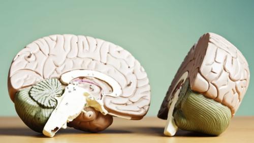 思想の左右ではなく極端さが脳を似せる