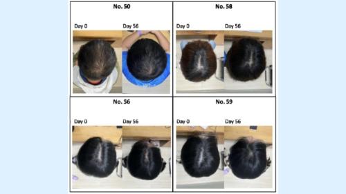 0日目と56日目の髪の比較。見た目でも大きく増えていることがわかります