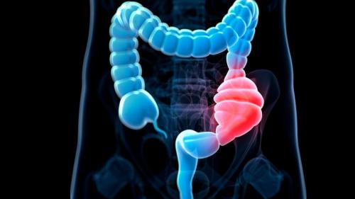 まとめ:便秘対策は『繊維だけ』の時代から『選ぶ時代』へ