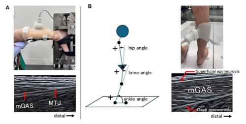 『腱トレ』で転倒リスクを下げられるか?