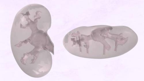 実験で使用された人工の腎臓モデル