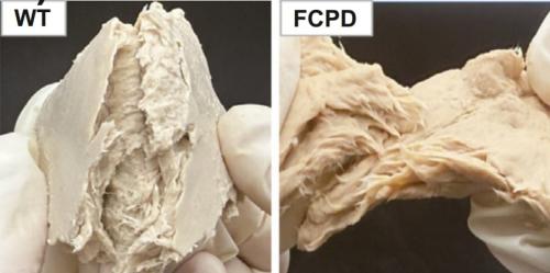 遺伝子編集で「菌のお肉」の生産速度が88%増加