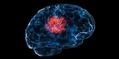 がん細胞の出す物質が脳をアルツハイマー病から守っていた
