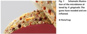 歯周病菌を「狙い撃ち」する新しい歯磨き粉が登場――善玉菌は減らさない