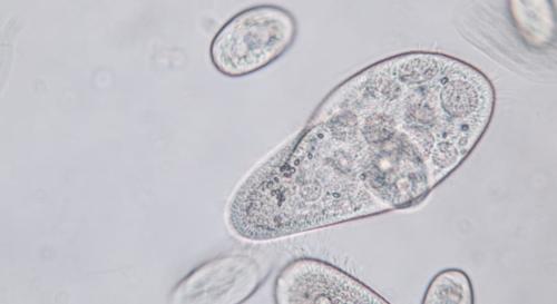 繊毛虫は何を取り込んでしまったのか？
