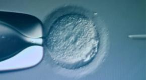 ヒト受精卵の遺伝子編集で有望な成果が報告された――最高の赤ちゃんにどこまで迫れるか？