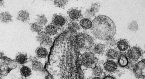 古代ウイルスの遺物がヒトの始まりを支えていた