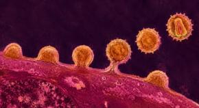 新生児のHIVを「3つの薬」で永久に排除できる可能性、サルの赤ちゃんで実証