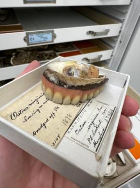 「人間の歯が生えたカキ」奇妙な標本が生まれた驚きの物語