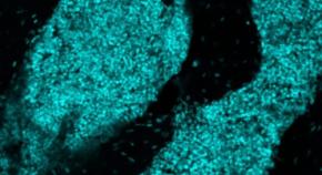 頭蓋骨の中に新たな「器官」を発見――そこは最前線で脳を守る免疫拠点だった