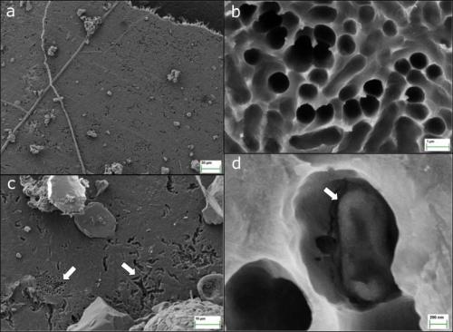 プラスチックを食べた酵素の「もう1つの顔」とは？