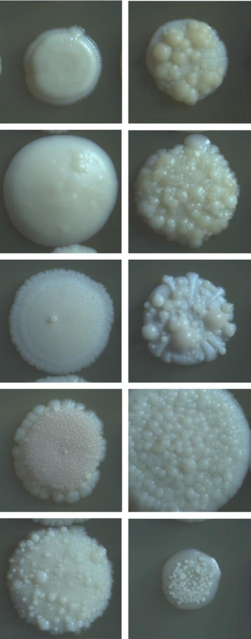 患者から採れた、いくつかのカンジダ・アウリスの株を、グリセリンを含む培地で育てたコロニー(菌の集まり)です。