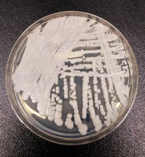 アメリカ疾病対策センター(CDC)の研究室で、培養皿に育てたカンジダ・アウリスの株です。