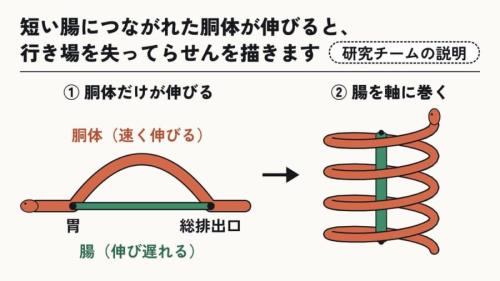 伸びすぎた胴体は、腸を軸に巻く