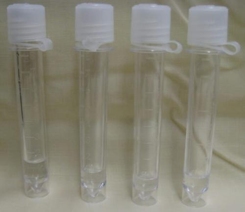 腰の背骨の間に針を刺して採った、人の脳脊髄液が入った4本の容器です。見た目はふつうの状態の脳脊髄液です。