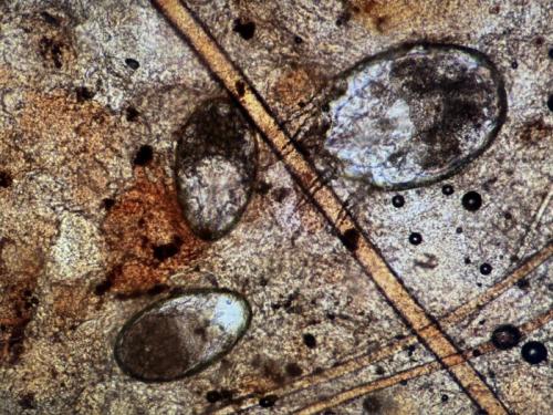 耳ダニの虫体と虫卵の顕微鏡画像