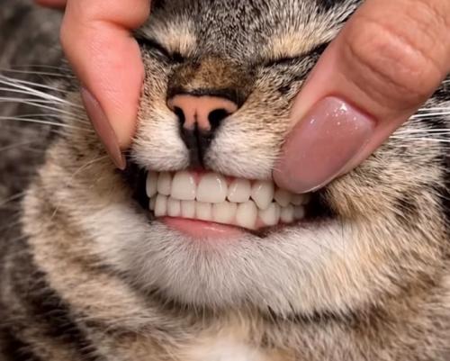 人間の歯