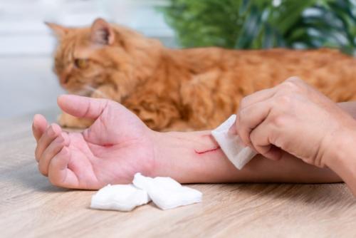 猫に引っ掻かれた飼い主