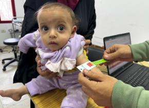 ガザ現地リポート:ガザ地区の子ども5歳未満の9300人が急性栄養不良…迅速かつ制限なき物資搬入を