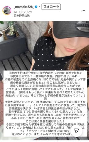 子宮体がん公表の元モデル、がん発覚の経緯明かし「開腹一択でした」