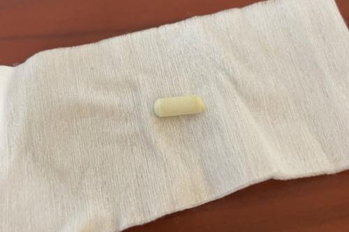 小学生の耳からシャーペン消しゴム 耳鼻科で無事摘出