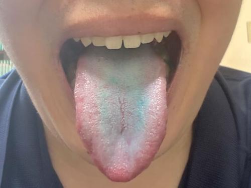 複数枚食べるとしっかり青く染まる