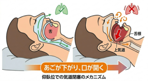 睡眠時の呼吸構造に関するトラタニ株式会社の調査報告