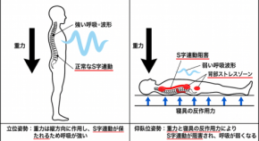 睡眠時無呼吸症候群(SAS)の新たなメカニズムと寝具・姿勢の物理的影響