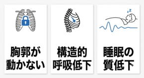 CPAP治療の限界と隠れ低呼吸の関係性について