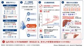 メタボ由来脂肪肝における新リスク病型を同定