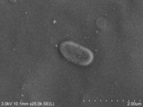 馬の呼吸器感染症から新種の細菌を発見