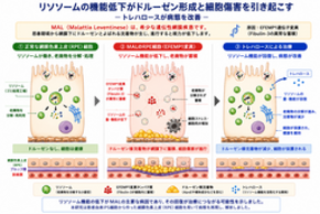 リソソーム異常が希少眼疾患の原因