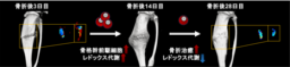 骨折治癒を担う細胞の代謝変化を超偏極MRIで可視化！