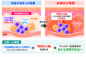 皮膚に残る「再燃の火種」を発見