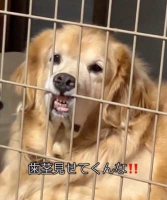 歯茎と前歯を出していくスタイル